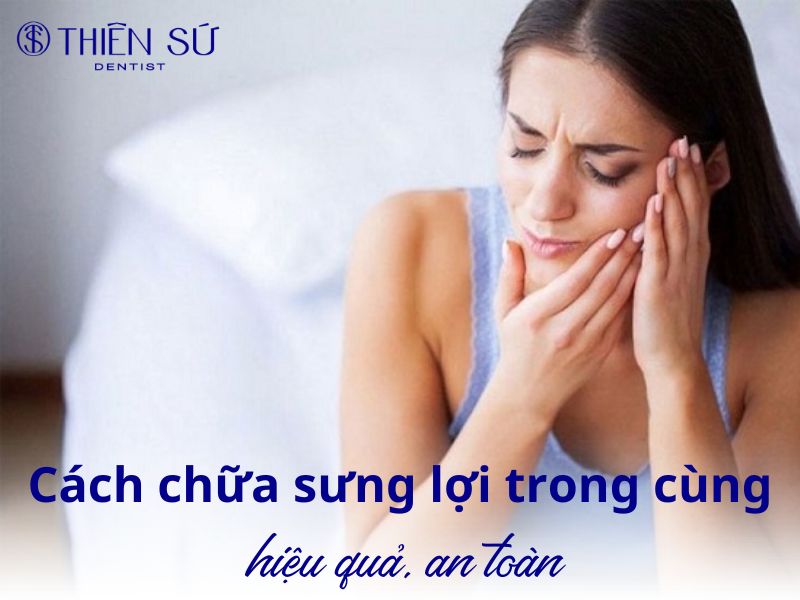 cách chữa sưng lợi trong cùng