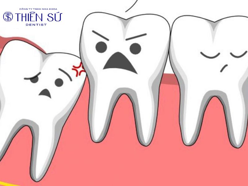 cách giảm đau khi mọc răng khôn