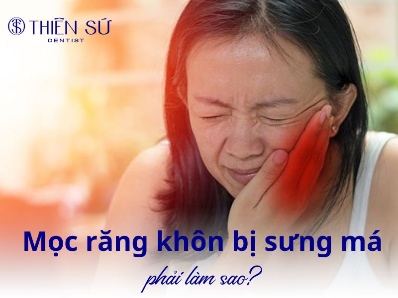 mọc răng khôn bị sưng má phải làm sao