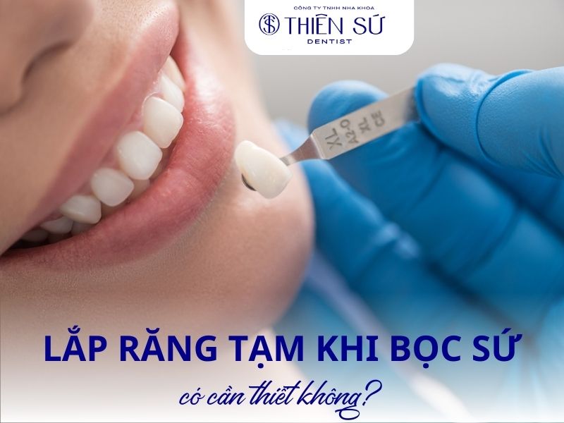 lắp răng tạm khi bọc sứ có cần thiết không