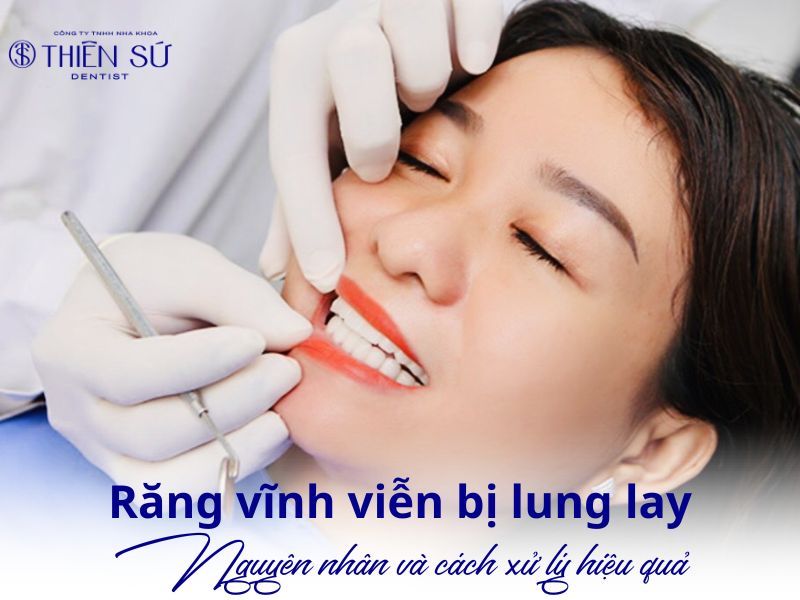 Răng vĩnh viễn bị lung lay